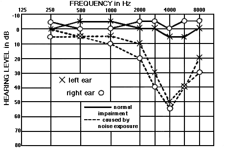 Diagram of High Frequency loss.