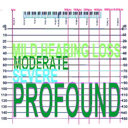 Audiogram