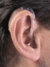 Profile photo of a BTE hearing aid