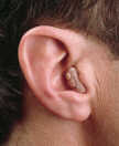 Profile photo of an ITC hearing aid