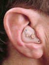 Profile photo of an ITE hearing aid